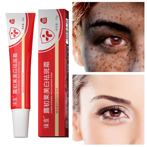 Freckle Whitening Cream Black Dots Melasma Remover Anti Brown Stain Lighten Pigmentation Moisturizing Skin Care Products 2023