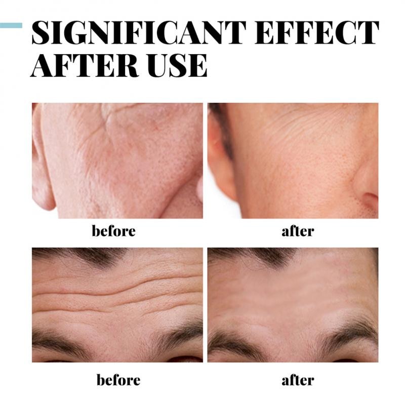 Men's Collagen Anti Wrinkle Creams Hyaluronic Acid Skin Firming Fade Fine Lines Hydrating Brightening Moisturizing Facial Cream